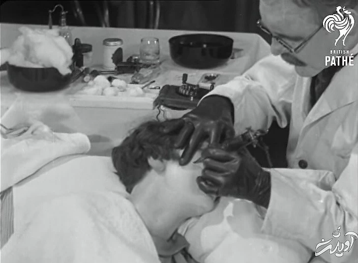 ۱۱ حقیقتی که ثابت می کند عمل های زیبایی از گذشته وجود داشتند